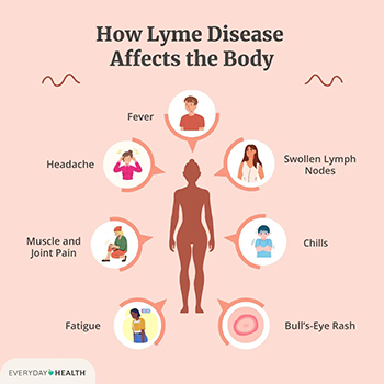 lyme1 lyme1
