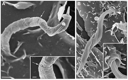 trypanosoma cruzi trypanosoma cruzi
