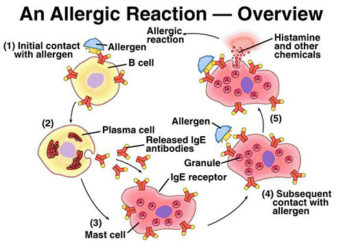 allergic reaction