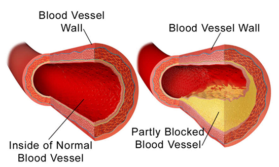 blood_vessel