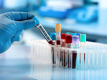 blood_test2 blood_test2