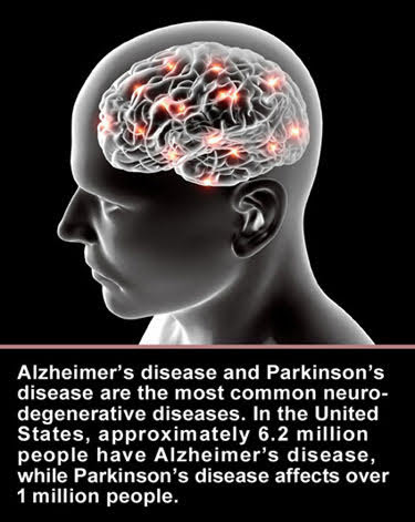 alzheimers_disease